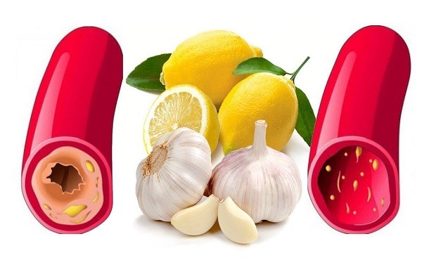چۆن خۆمان لەزیانەكانی كۆلیسترۆل بپارێزین